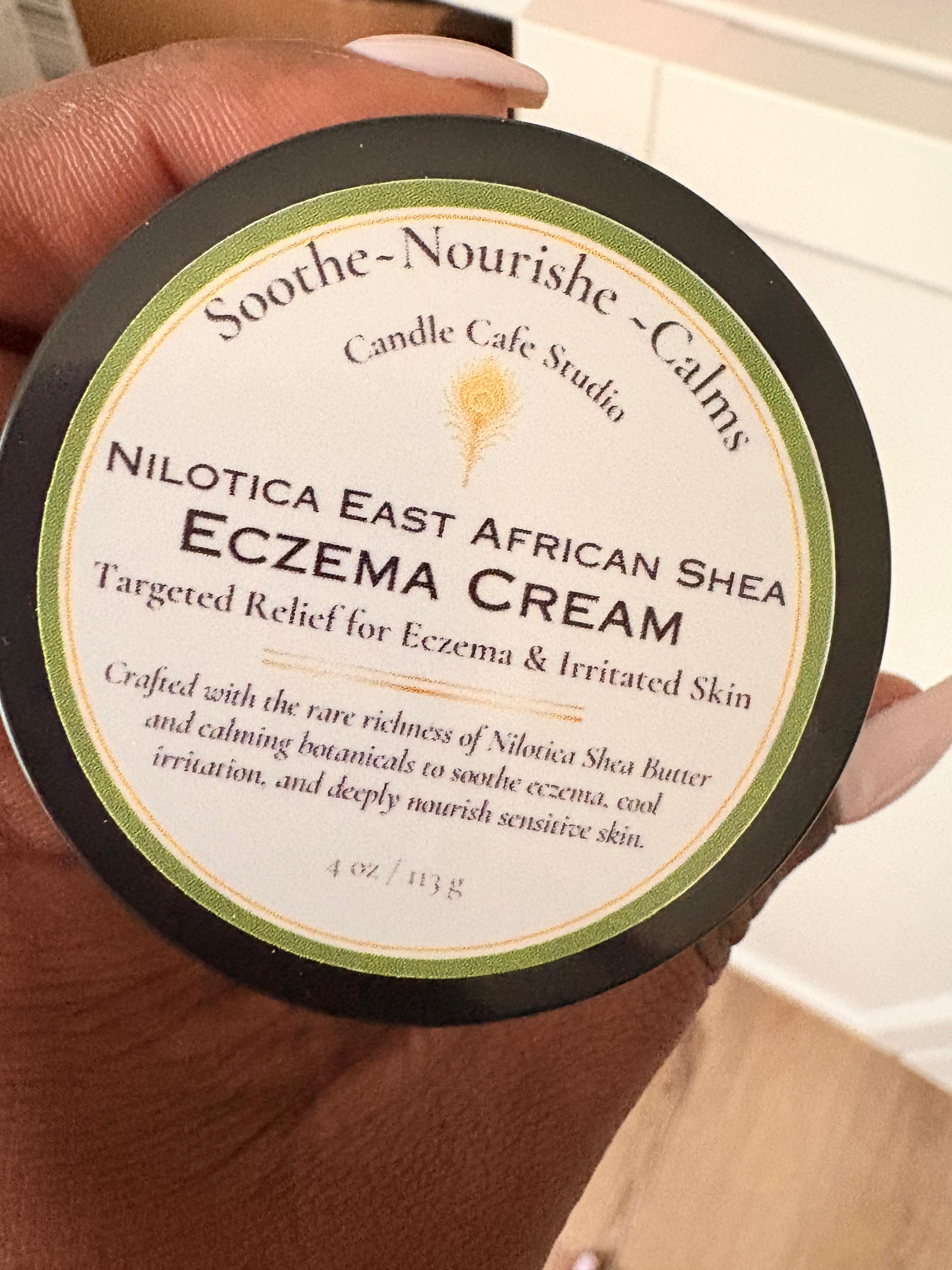 Eczema Cream- Nilotica East African Shea